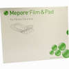Mepore Film Pad 9x15cm Mölnlycke Health Care 5 Stück - ab 8,24 €