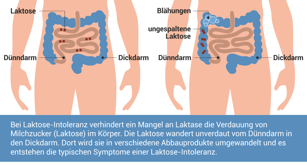 Fisch Allergien Symptome Erwachsene