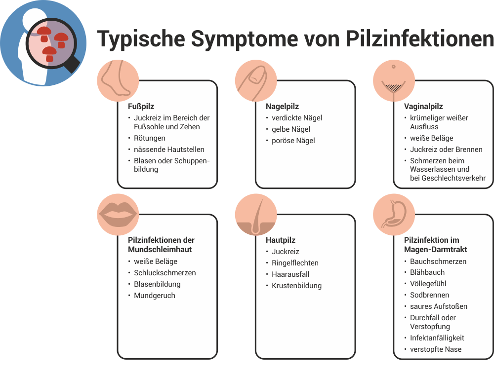 Typische Symptome bei Pilzinfektionen