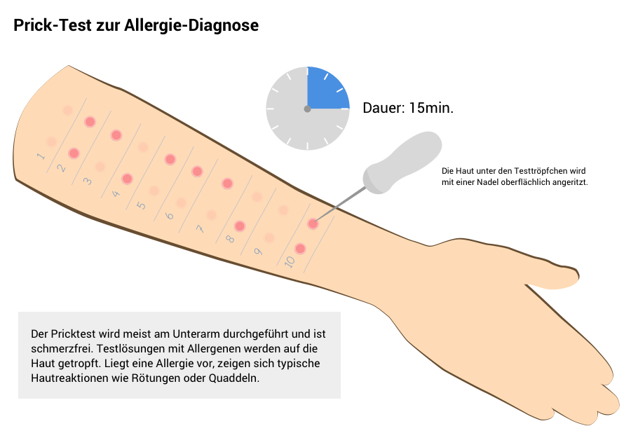 Prick-Test zur Allergie-Diagnose