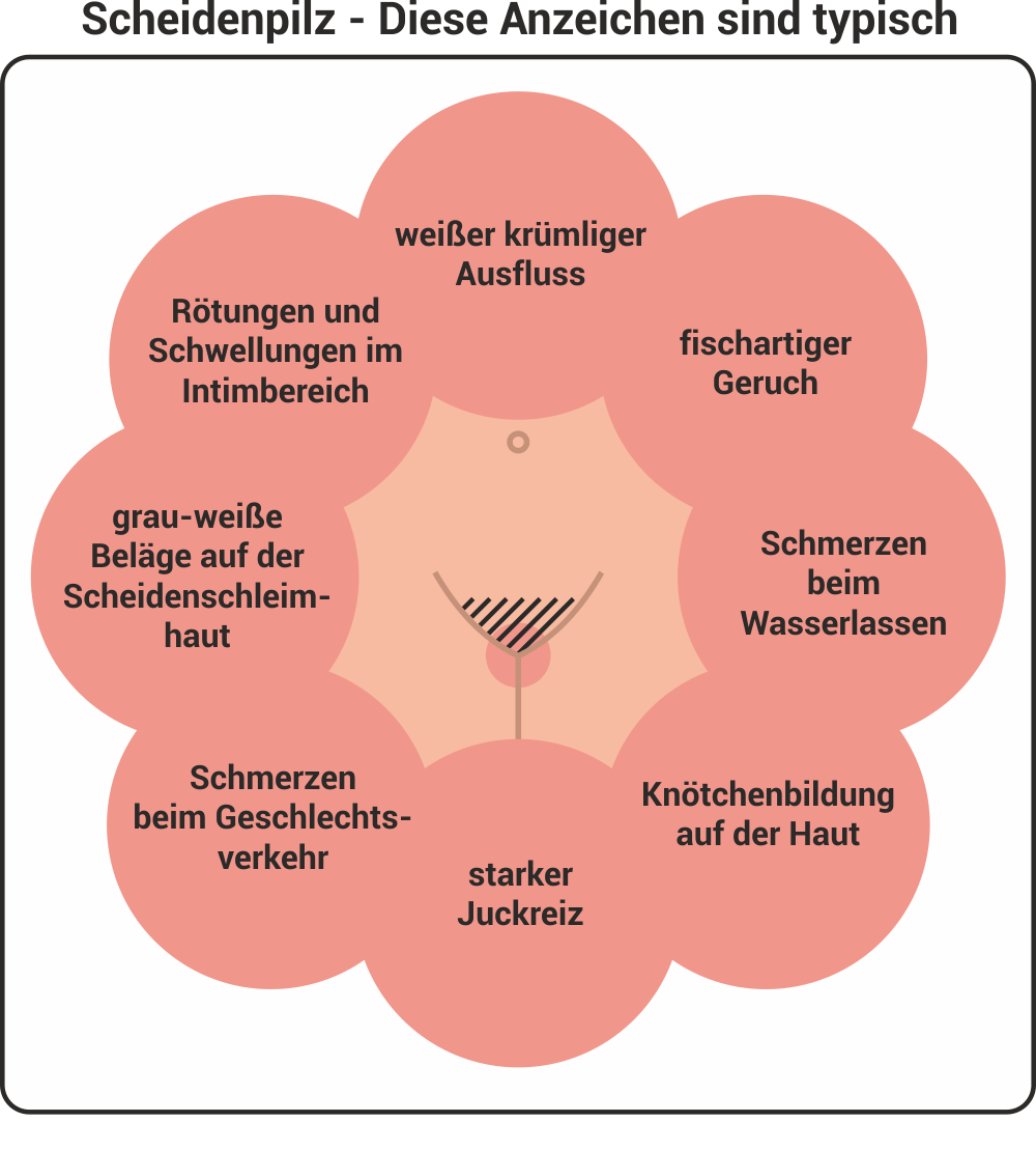 Nicht scheidenpilz weg geht Scheidenpilz geht