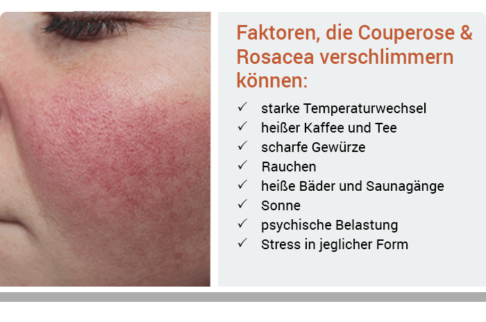 Faktoren, die Couperose & Rosacea verschlimmern können